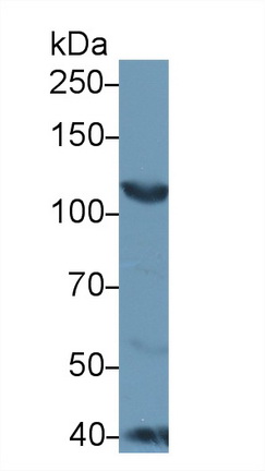 12364