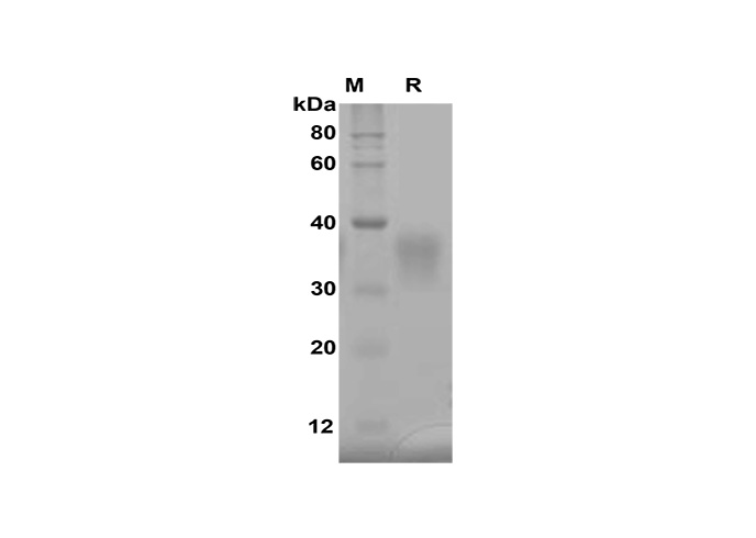 PDMM100250, электрофорез в ПААГ с ДСН