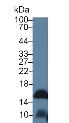 14254