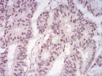 Валидация AntibodySystem RHG14204