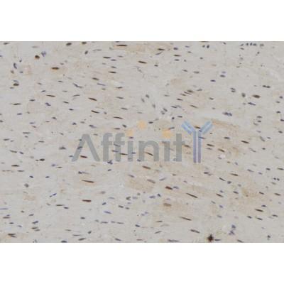 Валидация Affinity DF12232 - 6526