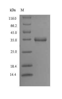 SDS-PAGE
