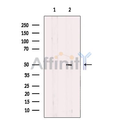 Валидация Affinity DF12047 - 6093