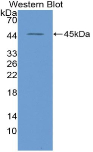 39813