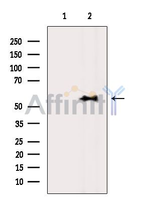 Валидация Affinity DF15289 - 11582