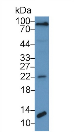 17704