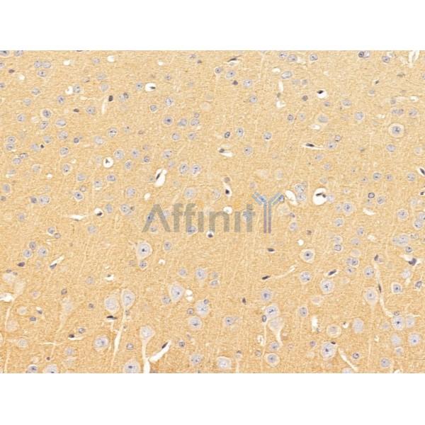 Валидация Affinity DF13644 - 9194