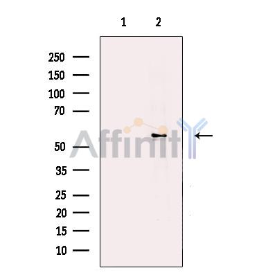 Валидация Affinity DF13577 - 9044