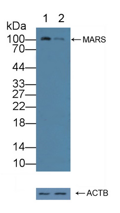 12258