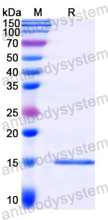 Валидация SDS-PAGE - AntibodySystem RXX10203