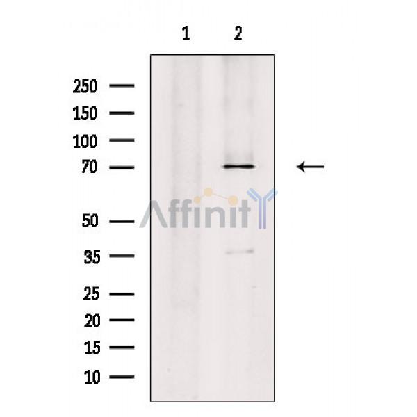 Валидация Affinity AF6814 - 4054