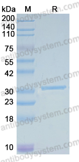 YVV47601, SDS-PAGE