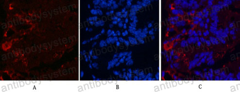 Валидация IF - AntibodySystem RHH46701