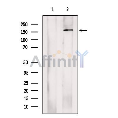 Валидация Affinity DF13600 - 9092