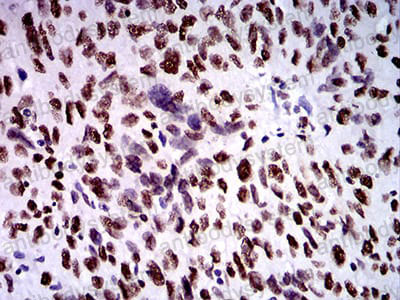 Валидация AntibodySystem RHN95902 (3999)