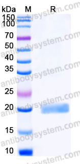 AHD17205, SDS-PAGE