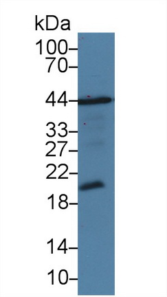 14011