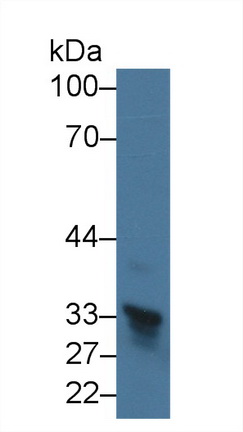 14771
