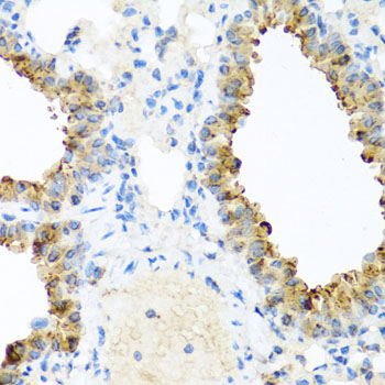 A8215, иммуногистохимия, ткань легкого мыши (18276)