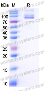 EHE65601, SDS-PAGE