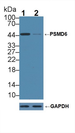 12285