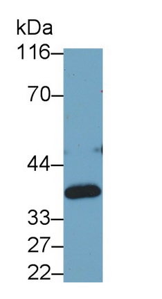 26056