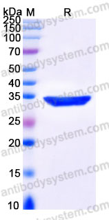 YHG37202, SDS-PAGE