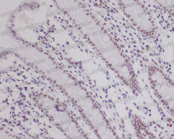 Валидация AntibodySystem RHD74301