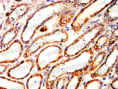 Валидация AntibodySystem RHC87702 (1141)