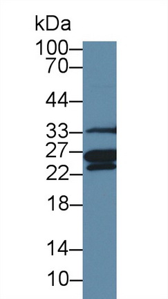 12694