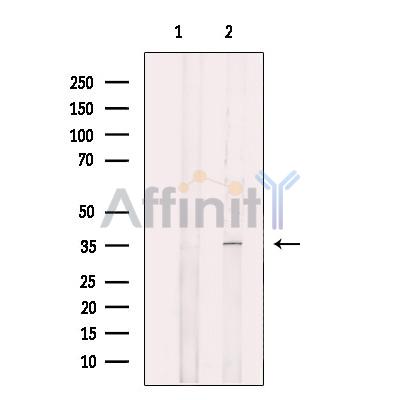 Валидация Affinity DF12392 - 6871
