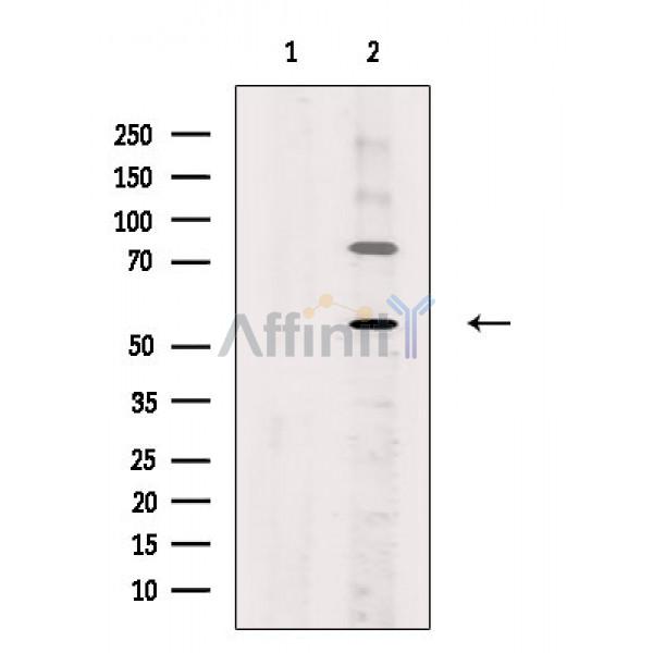 Валидация Affinity DF10078 - 5561