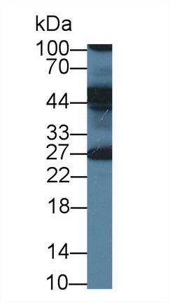 14024