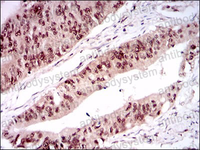 Валидация AntibodySystem RHA90601