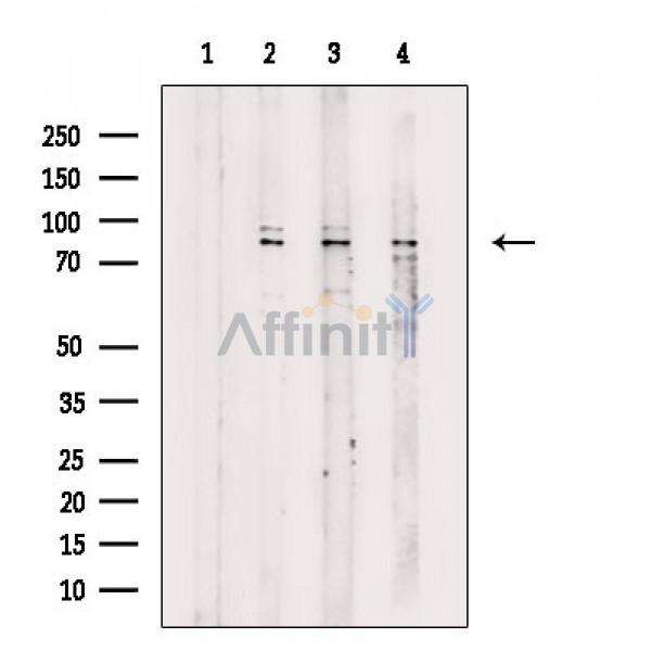 Валидация Affinity DF8456 - 20337