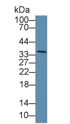 60076
