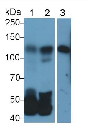 14251