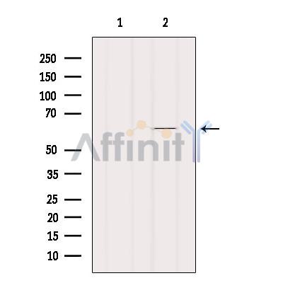 Валидация Affinity DF4632 - 16270