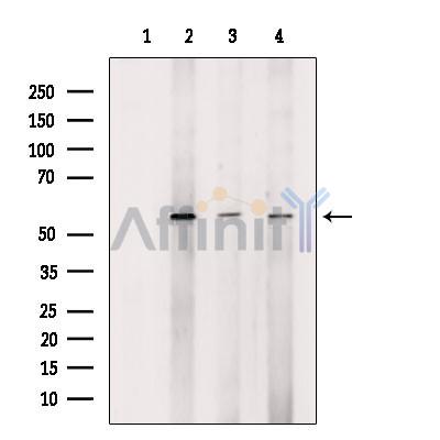 Валидация Affinity DF10004 - 5440