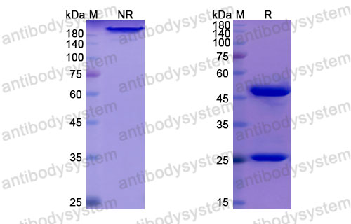 Валидация SDS-PAGE - AntibodySystem DHB74004