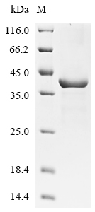 SDS-PAGE