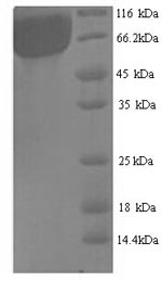 SDS-PAGE