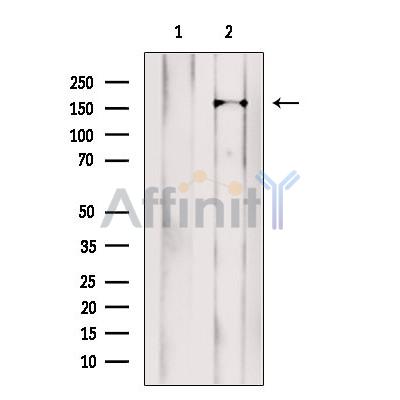 Валидация Affinity DF13511 - 8910