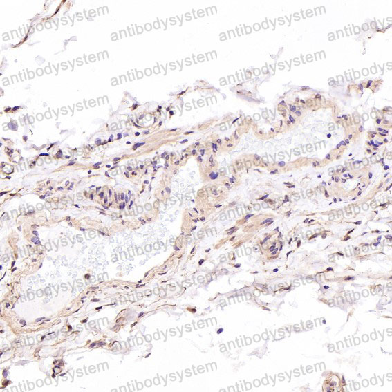 Валидация AntibodySystem RHC69301 (1058)