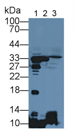 11921