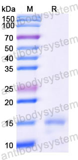 Валидация SDS-PAGE - AntibodySystem RHD08901
