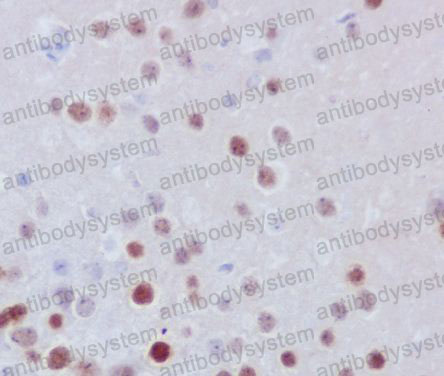 Валидация AntibodySystem RHE98201