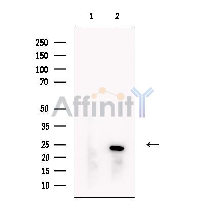 Валидация Affinity DF13751 - 9406