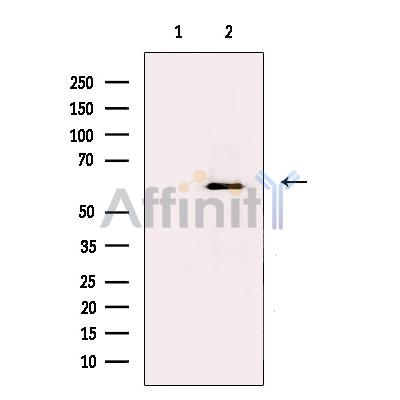 Валидация Affinity DF13733 - 9374
