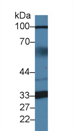 14377